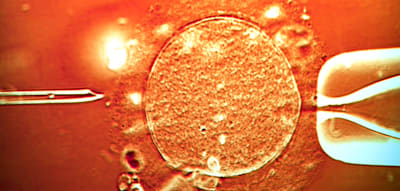 In Großbritannien werden Babys mit drei Eltern geboren