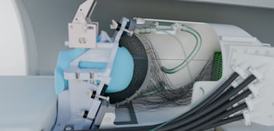 „Bemerkenswerte Genauigkeit“ – ein Ultraschallhelm soll künftig gegen Parkinson helfen