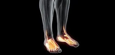 Krafttraining sollte barfuß gemacht werden – maximal mit Socken