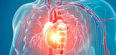 So stark erhöht die Grippe das Risiko für Herzinfarkt und Schlaganfall