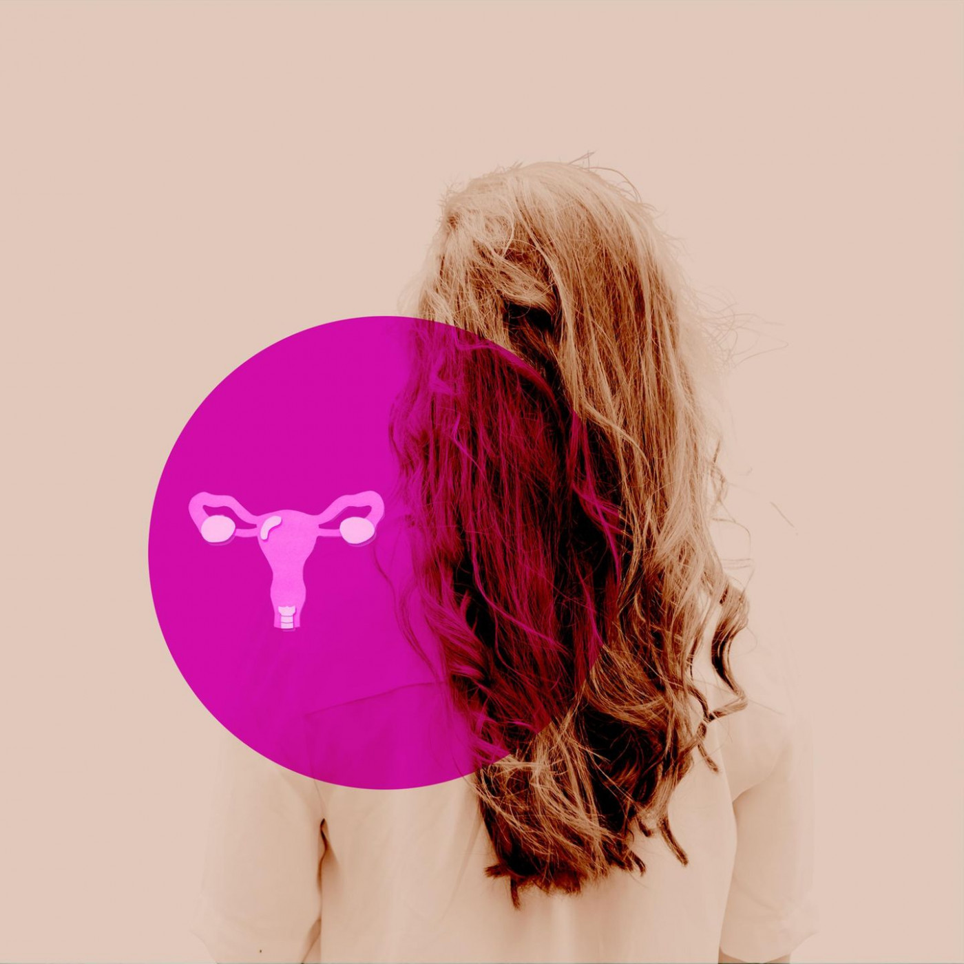 Ingrid K. litt an starken Monatsblutungen. Das war nur der Anfang