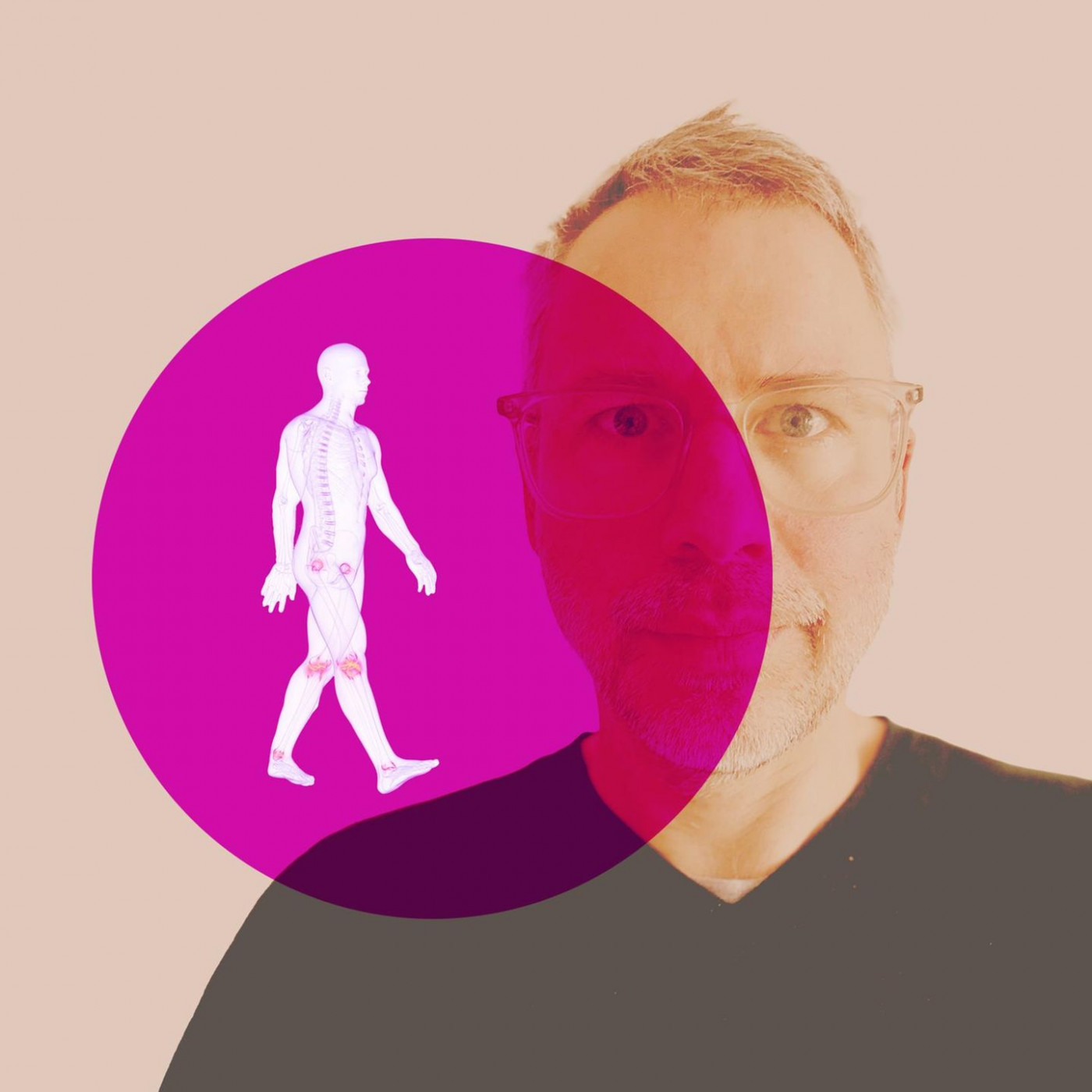 Leben mit Rheuma: Wie ich den Feind im eigenen Körper besänftigte