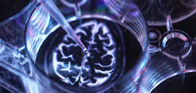 „Wir sehen immer wieder ein starkes Schutzsignal für Demenz“