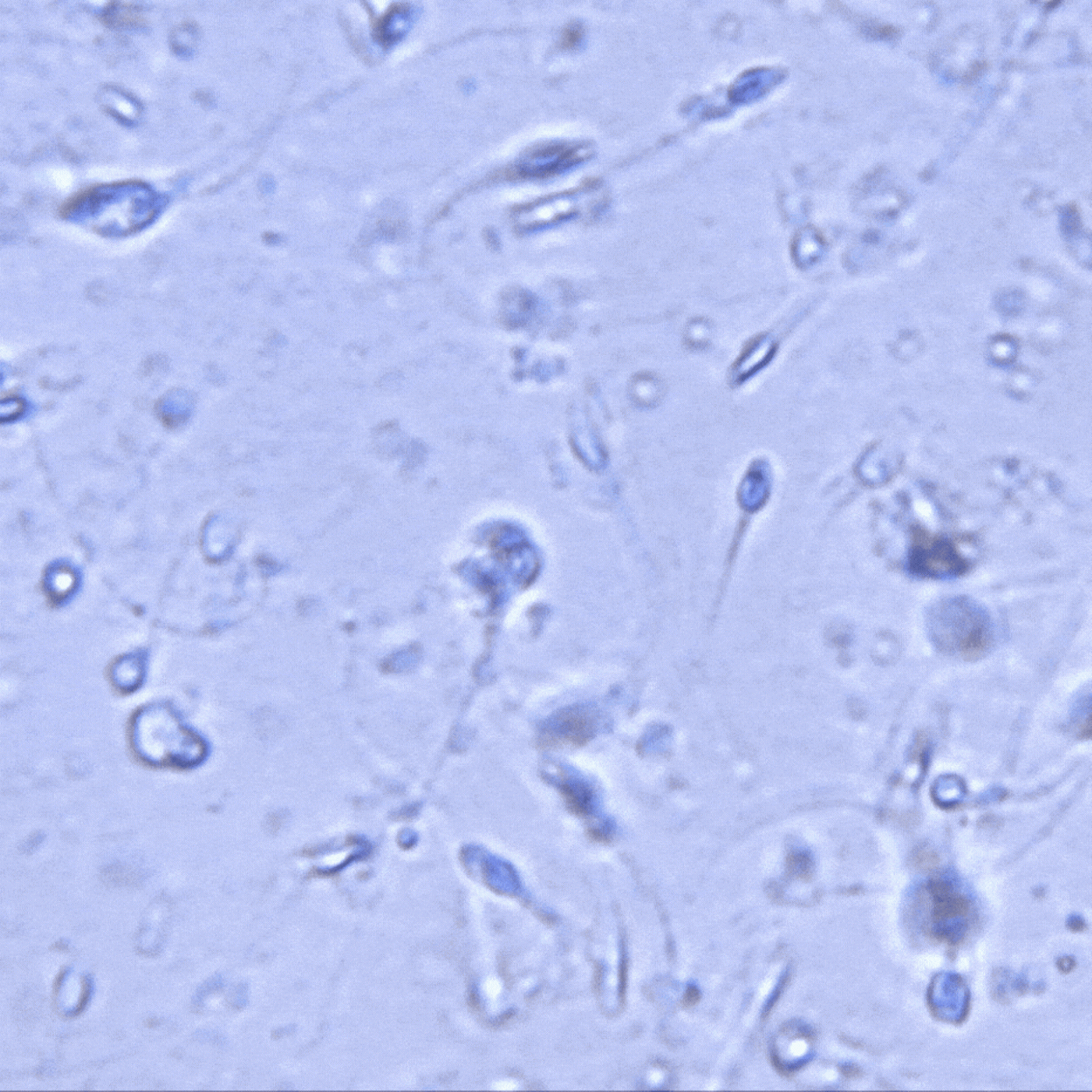 Wenn der Mann dauerhaft verh&uuml;tet