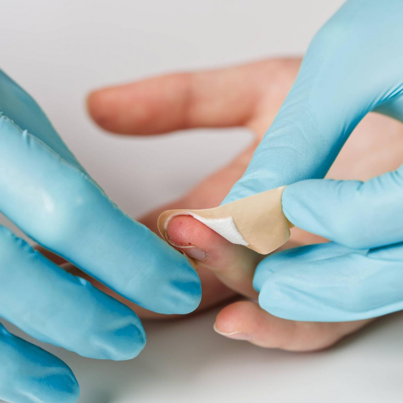 Ein kleine Wunde am Finger kann im Extremfall die ganze Hand kosten