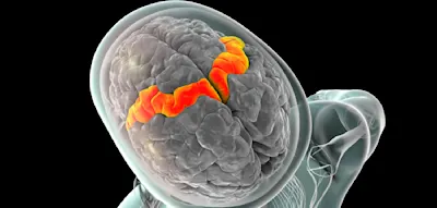 Forscher entschl&uuml;sseln Gedanken mithilfe von Gehirn-Chip