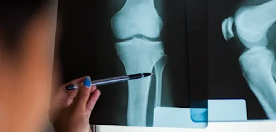 17 Zentimeter l&auml;nger &ndash; das gef&auml;hrliche Gesch&auml;ft mit der Gr&ouml;&szlig;e