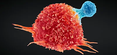 14 M&ouml;glichkeiten, das pers&ouml;nliche Krebsrisiko effektiv zu senken