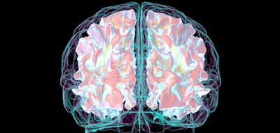 Das Training zweier kognitiver F&auml;higkeiten senkte das Alzheimer-Risiko um 25 Prozent