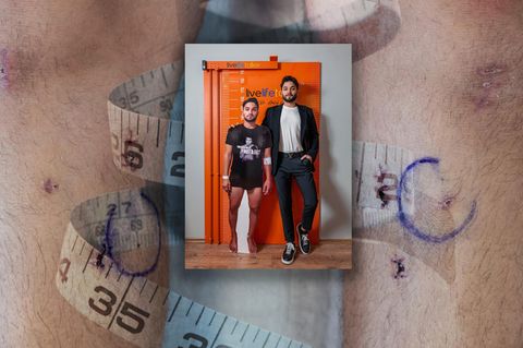 Diese M&auml;nner fahren in eine Klinik, um sich die Beine brechen zu lassen. Warum?