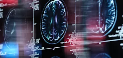 Gehirnscans zeigen, warum viele Menschen mit zweierlei Ma&szlig; messen