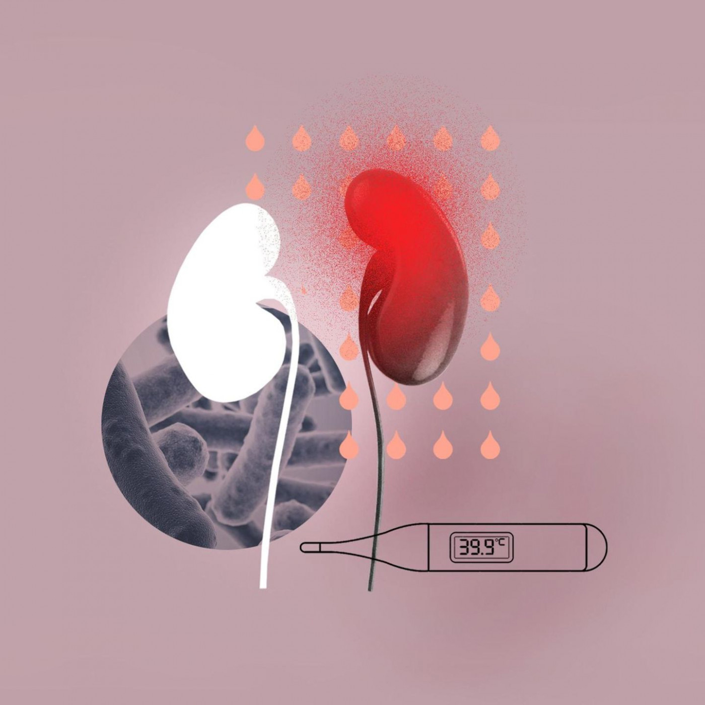 R&auml;tselhafte Luftniere