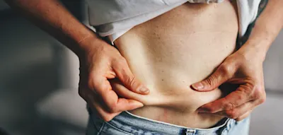 &bdquo;Pr&auml;diabetes ist mit dauerhaften Ver&auml;nderungen im Fettgewebe verbunden&ldquo;