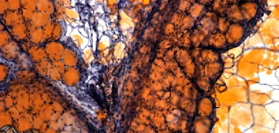 Die erstaunlichen Spuren, die &Uuml;bergewicht im Immunsystem hinterl&auml;sst