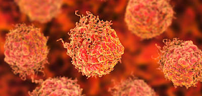 Forscher entdecken Zusammenhang zwischen aggressiven Tumoren und Testosteronspiegel