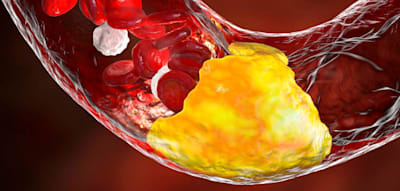 &bdquo;Ern&auml;hrung hat nur einen geringen Einfluss auf den Cholesterinspiegel&ldquo;