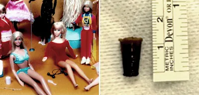 51 Jahre Lungenprobleme &ndash; Kanadierin lebte mit Barbie-Zubeh&ouml;r im K&ouml;rper
