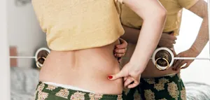 Hormonbauch? &bdquo;Der ist definitiv kein Mythos mehr&ldquo;